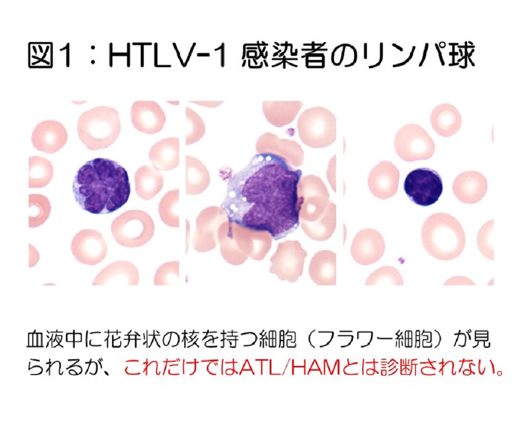 htlv 1 抗体 と は